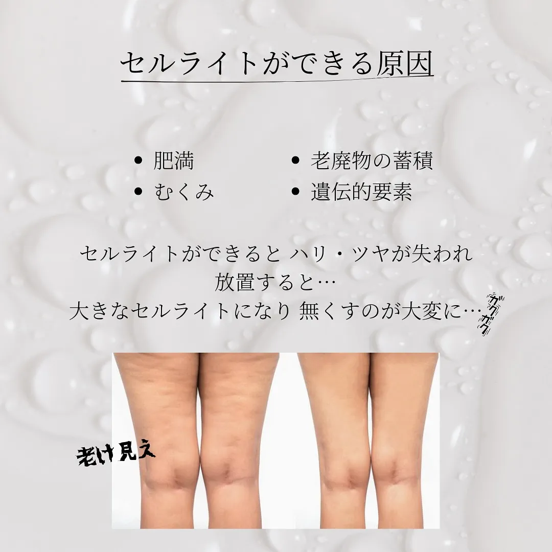 痩身